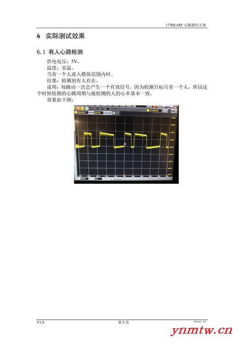 养老院监控系统177HEART心跳感应方案图2